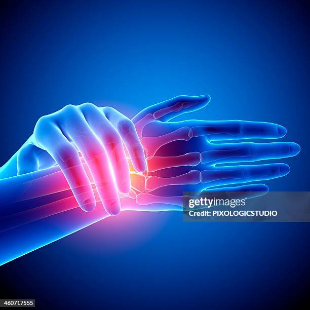 wrist pain, artwork - handgelenk stock-grafiken, -clipart, -cartoons und -symbole
