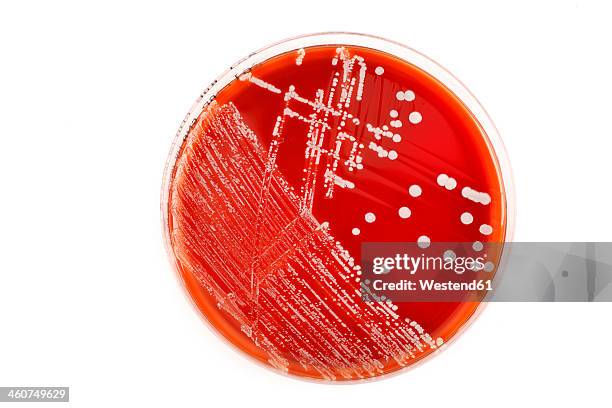 red petri dish with bacteria on white background - boîte de pétri photos et images de collection