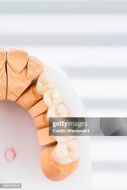 germany, freiburg, finished model of dental bridge, close up - gebiss mensch zähne stock-fotos und bilder