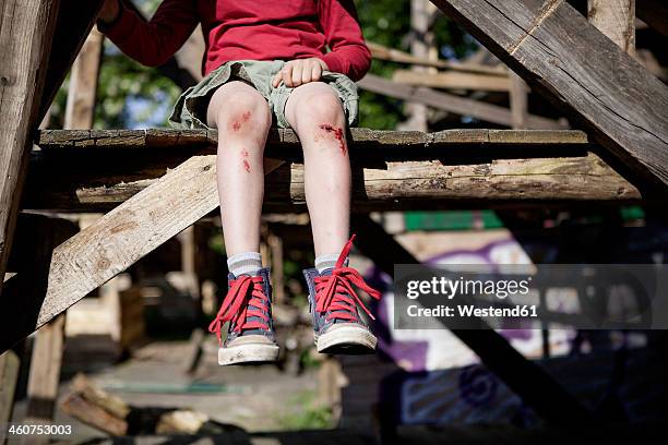 germany, north rhine westphalia, cologne, boy injured in playground - injured knee stock pictures, royalty-free photos & images