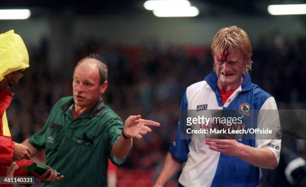 August 1994 - Premiership - Arsenal v Blackburn Rovers - Colin Hendry of Blackburn has a huge cut on his forehead which catches the attention of the...