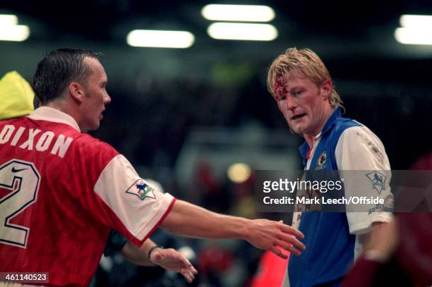 August 1994 - Premiership - Arsenal v Blackburn Rovers - Colin Hendry of Blackburn has a huge cut on his forehead which catches the attention of...