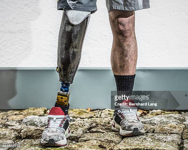 man with prosthetic leg - artificial limb stockfoto's en -beelden