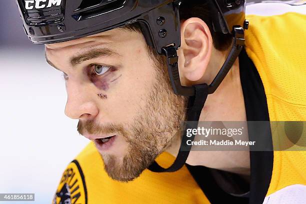 Adam McQuaid of the Boston Bruins looks on during the second period against the Columbus Blue Jackets at TD Garden on January 17, 2015 in Boston,...