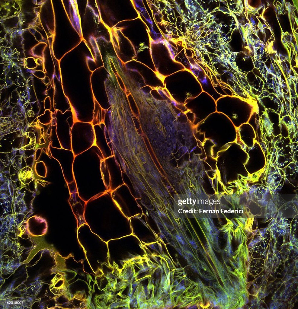 Confocal microscopy of plants
