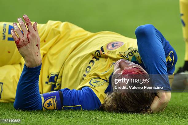 Nicolas Frey of AC Chievo Verona lies injured during the Serie A match between Juventus FC and AC Chievo Verona at Juventus Arena on January 25, 2015...