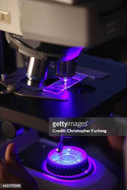 Scientist observes chromosones through a microscope using FISH at Birmingham Women's Hospital on January 22, 2015 in Birmingham, England. Birmingham...