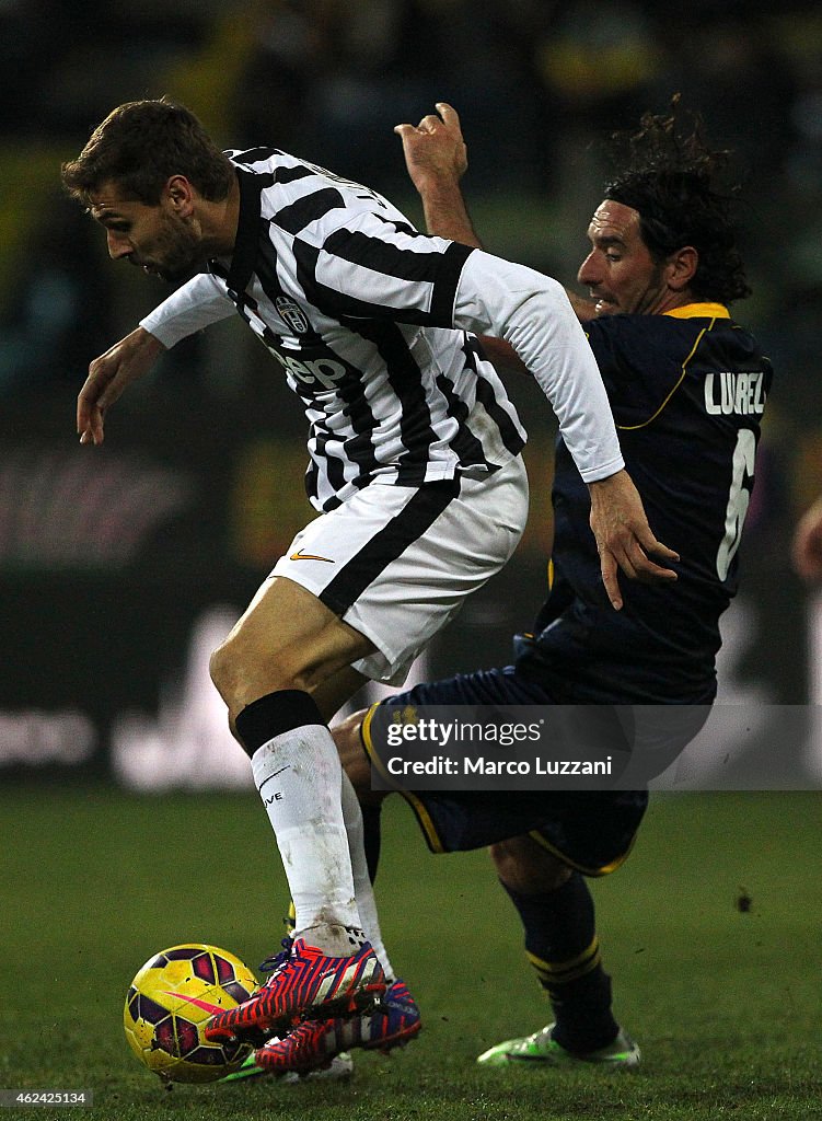 Parma FC v Juventus FC - TIM Cup