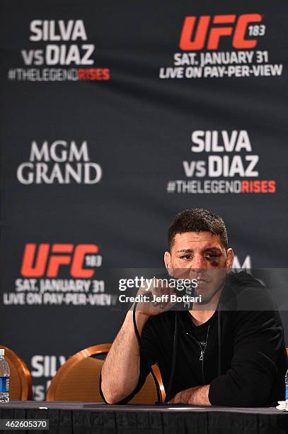 Nick Diaz interacts with the media during the UFC 183 post fight press conference at the MGM Grand Garden Arena on January 31, 2015 in Las Vegas,...