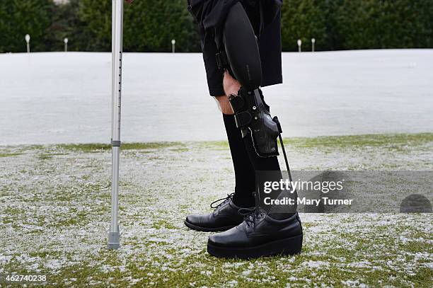 John Simpson displays the C-Brace lower limb bionic exo-skeleton that has allowed him to walk naturally for the first time in 40 years at the Royal...