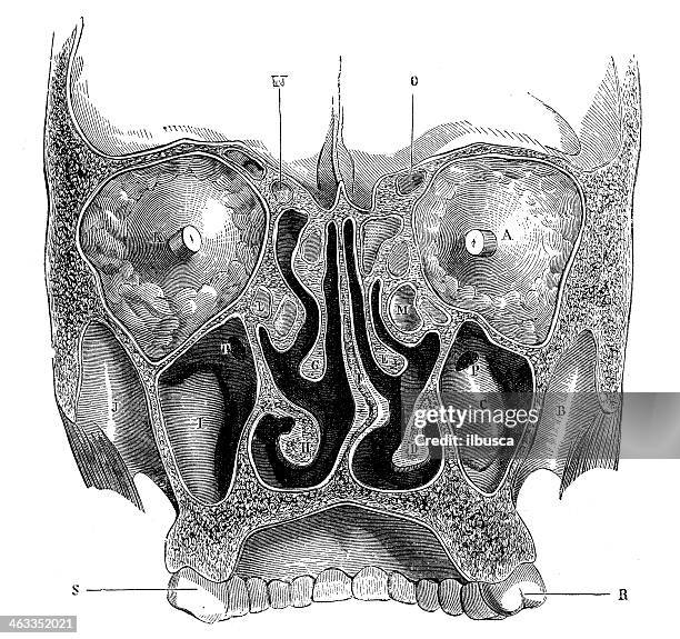 antique medical scientific illustration high-resolution: face frontal section - operating center stock illustrations