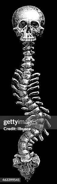 antique medical scientific illustration high-resolution: scoliosis - human anatomy organs back view stock illustrations