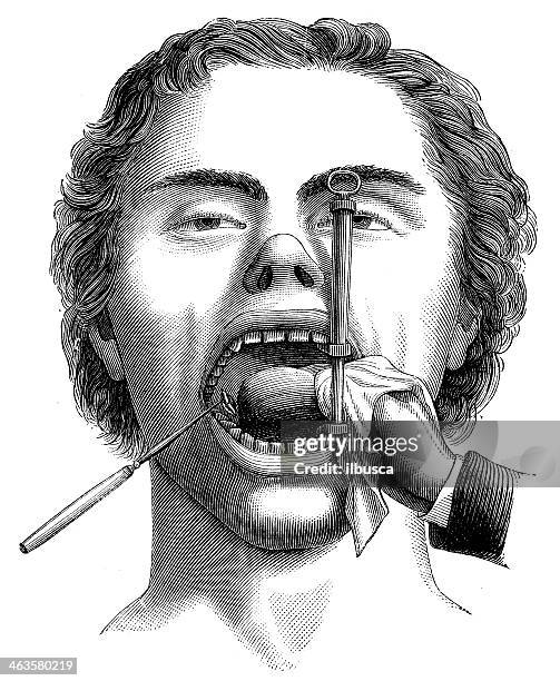 ilustraciones, imágenes clip art, dibujos animados e iconos de stock de anticuario científica médica ilustración de alta resolución: boca de la cirugía - cadáver