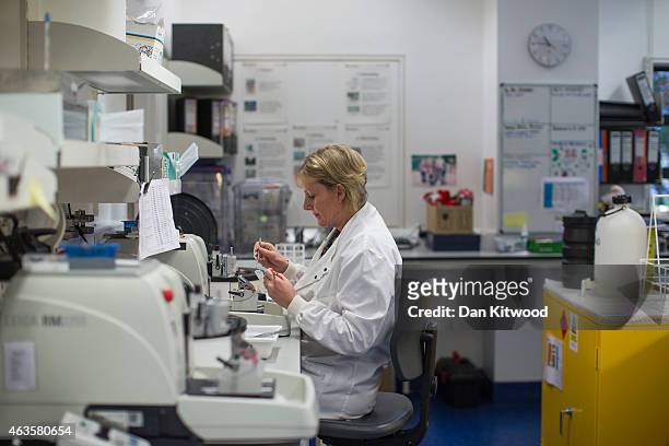 Scientist cuts thin sections from a tissue biopsy that has been preserved in wax, to be then placed on microscope slides for analysis, at the Cancer...
