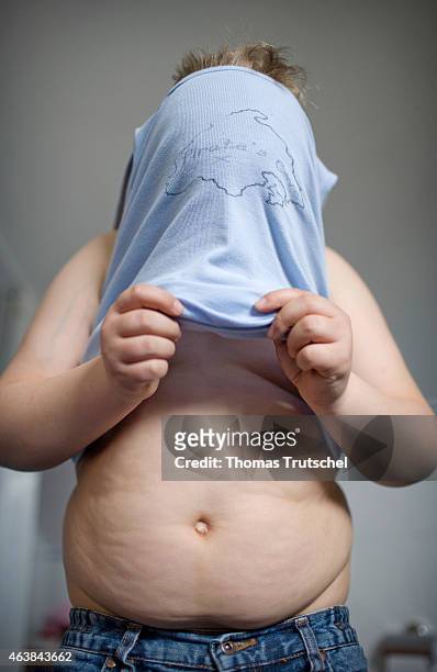 Overweight boy gets dressed on April 14, 2009 in Berlin, Germany. Obesity is most commonly caused by a combination of excessive food energy intake,...