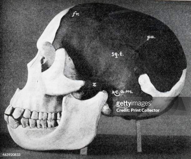 Model of the skull of Piltdown Man , 1914. Model as reconstructed by Dr Smith Woodward. Dark areas are from the original fossil, the light are the...