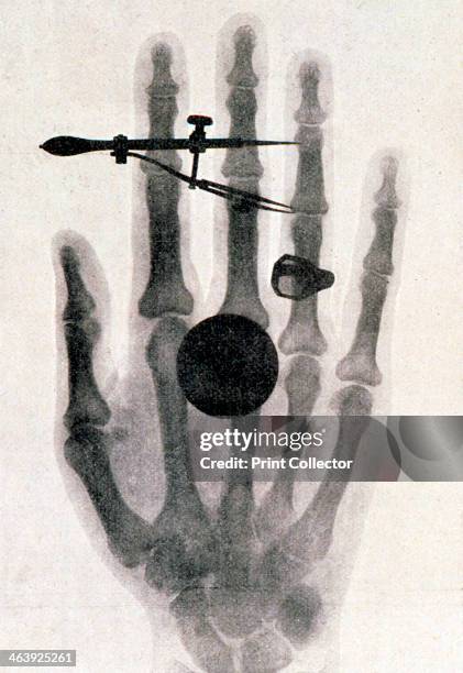 Wc Rontgen 226 Wilhelm Conrad Roentgen Stock Photos, High-Res Pictures, and Images ...