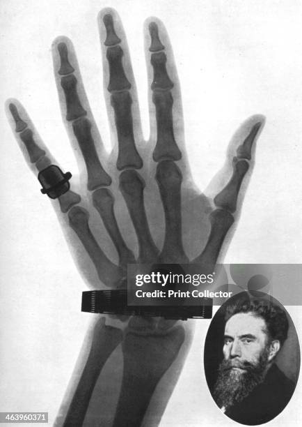 Wc Rontgen 294 Wilhelm Conrad Roentgen Stock Photos, High-Res Pictures, and Images ...