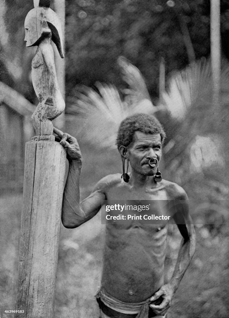 Malformation of the ears, Solomon Islands, 1920.Artist: JW Beattie