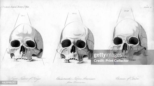 Three types of human skull, 1848. Comparison of a Negro , Chilamache native American , and Chinese . During the 19th century, it was believed that...