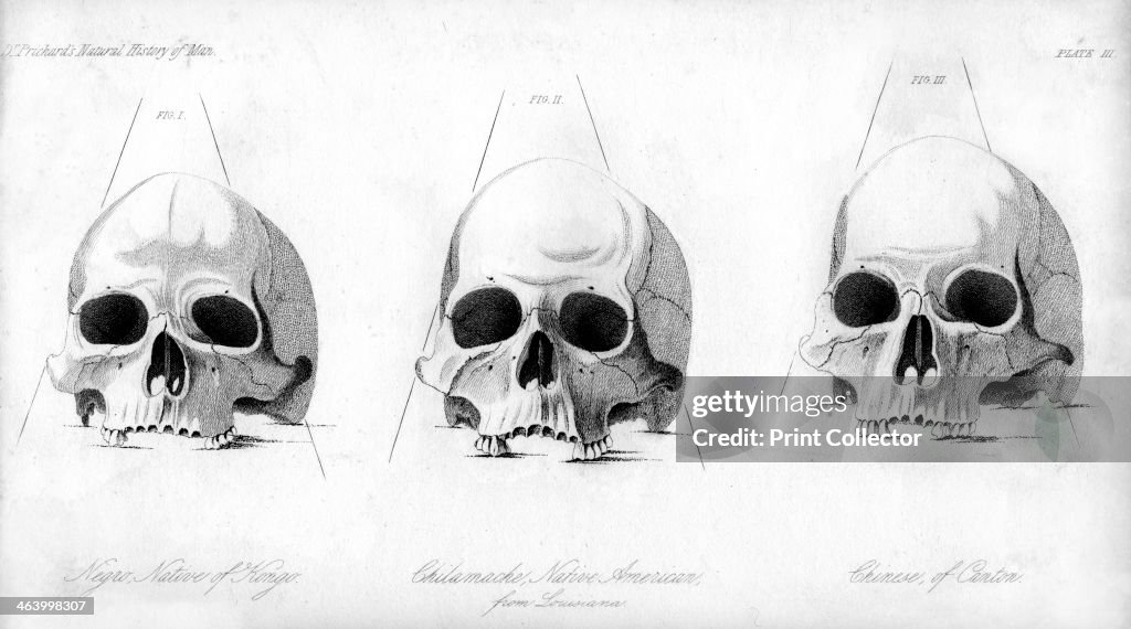 Three types of human skull, 1848.