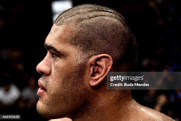 Detail of the ear by Antonio Bigfoot Silva of Brazil after losing the fight to Frank Mir of the United States after their heavyweight bout during the...