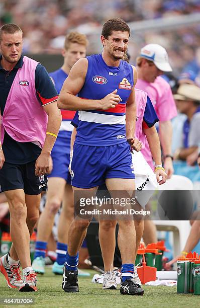 Tom Liberatore of the Bulldogs hobbles off with a leg injury during the NAB Challenge AFL match between the Western Bulldogs and the Richmond Tigers...