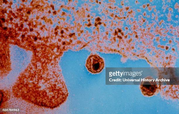 Image of Aids virus from Uganda. World Health Organisation/Institut Pasteur