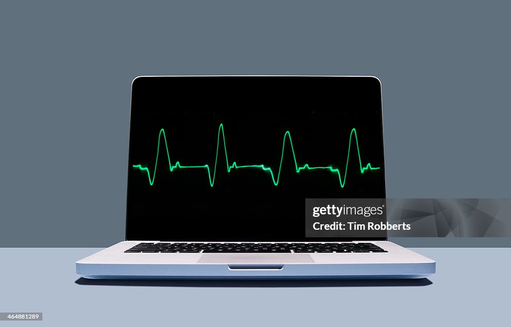 Laptop with healthy heartbeat pulse.