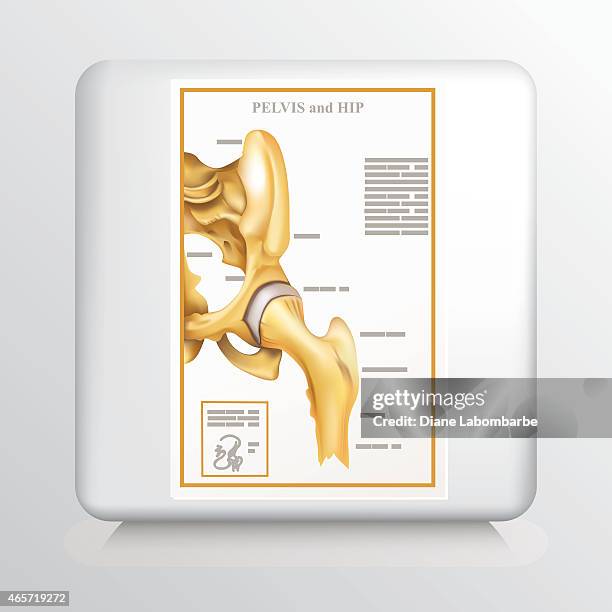 square icon with hip joint doctor's chart - hip bone stock illustrations