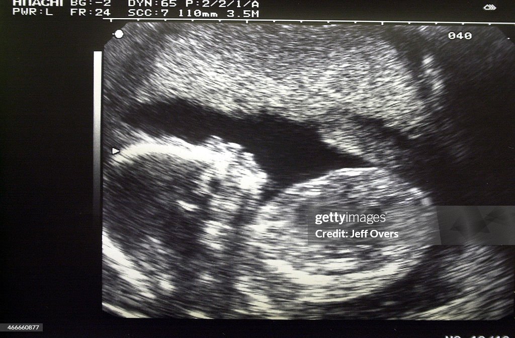 Ultrasound scan of baby during pre-natal examination