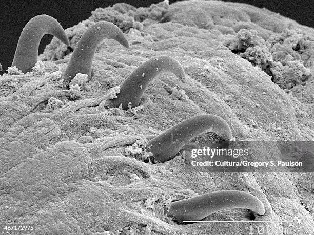 tapeworm (cestoda) scolex sem - escólex imagens e fotografias de stock