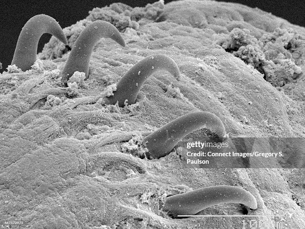 Tapeworm (Cestoda) scolex SEM