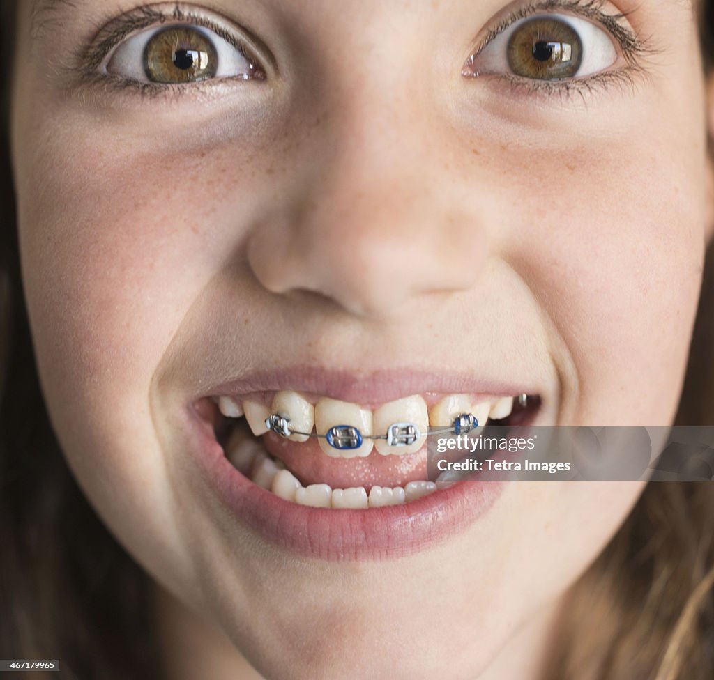 USA, New York, New York City, Girl (8-9) showing braces
