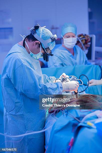 surgeon using defibrillator in open heart surgery - open heart surgery foto e immagini stock