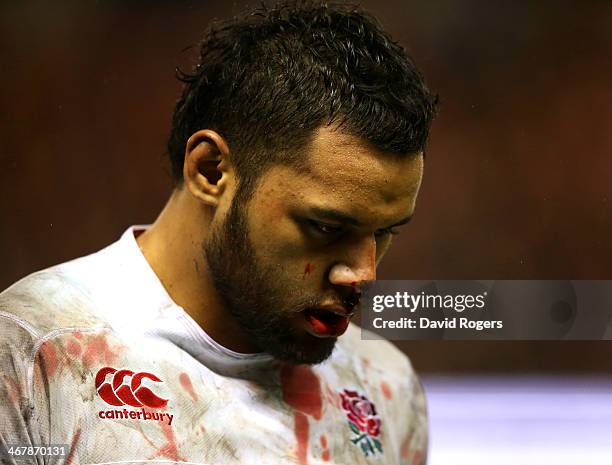 Billy Vunipola of England leaves the field for treatment for his bloody face during the RBS Six Nations match between Scotland and England at...