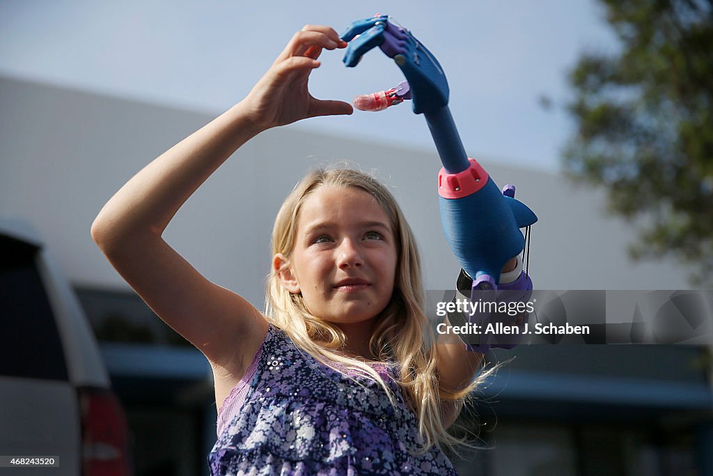 Girl Receives Limb Created By 3D Printer