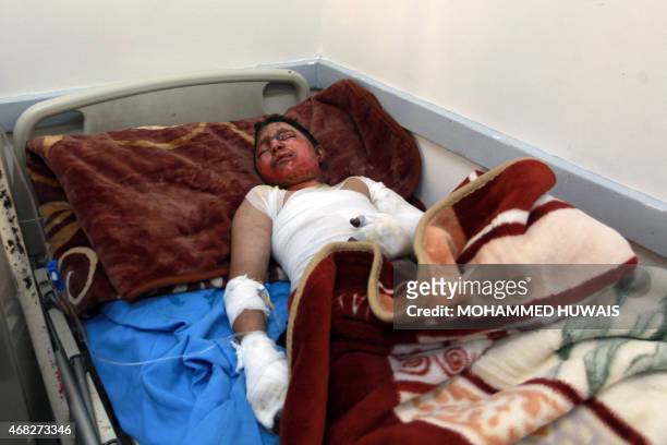Yemeni child receives treatment on April 1 at the burn unit of a hospital in Yemeni capital of Sanaa, following a reported airstrike by the Saudi-led...