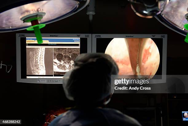 Dr. Peter Witt, University of Colorado neurosurgeon who specializes in spinal surgeries, performs a percutaneous endoscopic lumbar discectomy, a...