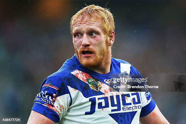 James Graham of the Bulldogs leaves the field after sustaining a head plays a cut shot during the round five NRL match between the Canterbury...