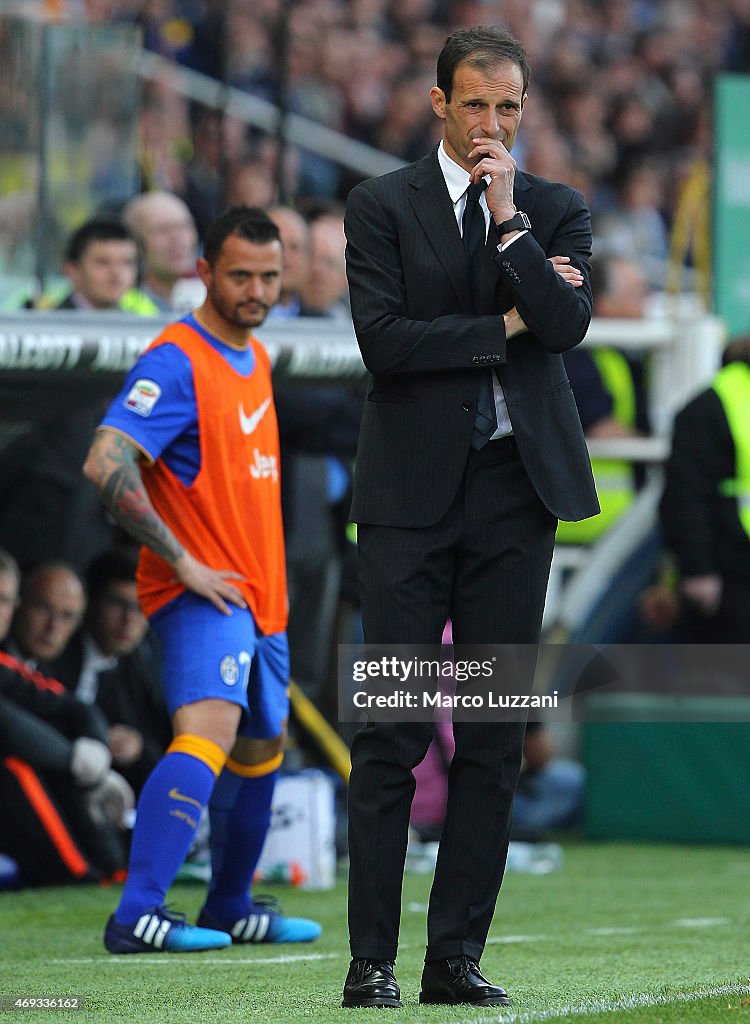 Parma FC v Juventus FC - Serie A
