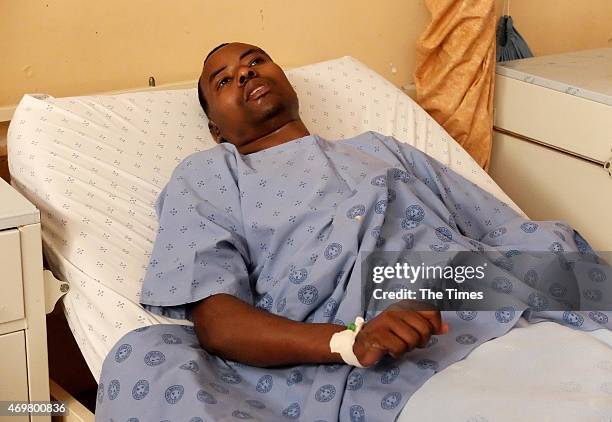 Victim of the KwaZulu-Natal xenophobic attacks, Alex Marcus during an interview at Prince Mshiyeni Hospital on April 11, 2015 in Durban, South...