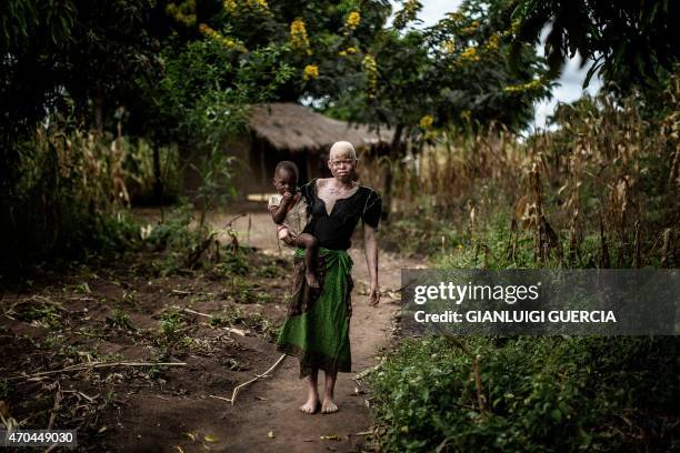 Mainasi Issa, a 23-year-old Malawian albino woman, carries her tow-year-old daughter Djiamila Jafali as she poses outside her hut in the traditional...