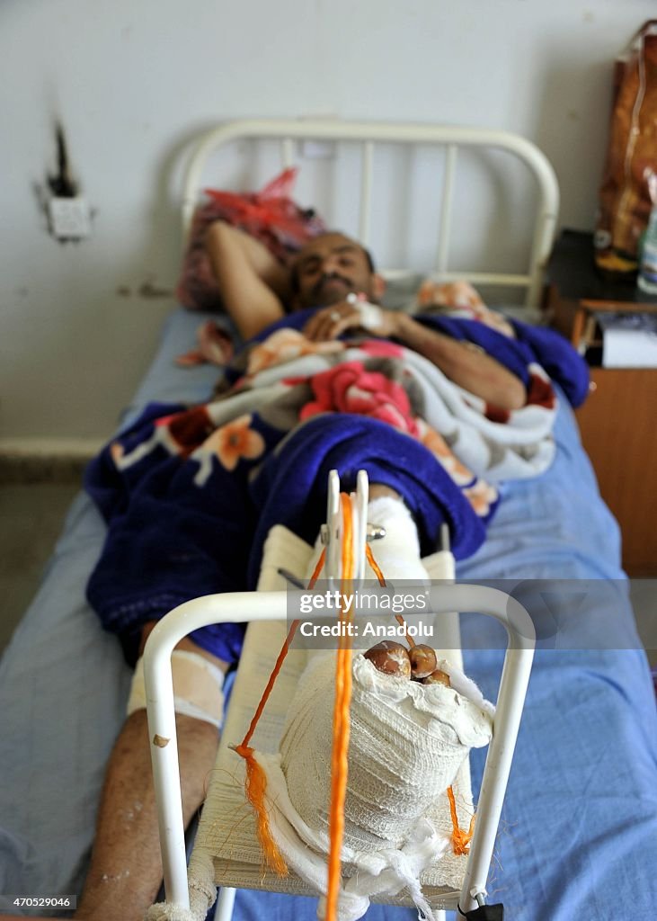 Injured Yemenis receive treatment following Saudi-led air operation in Sana'a