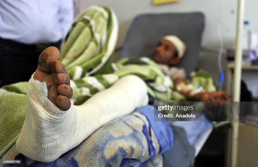 Injured Yemenis receive treatment following Saudi-led air operation in Sana'a