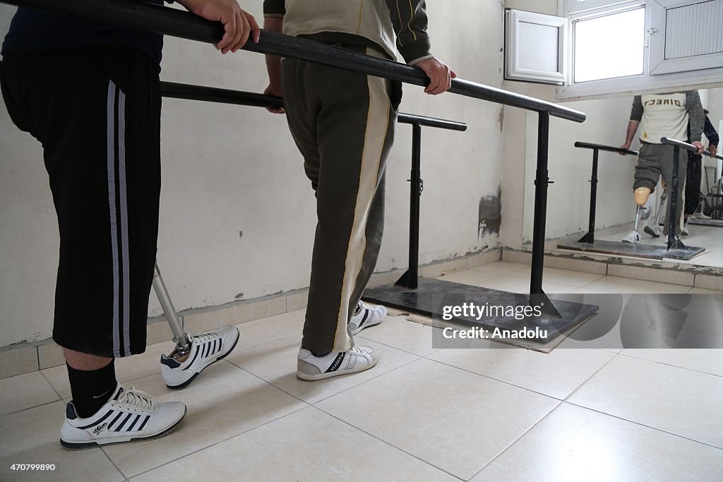 Prosthetics center for Syrians in Hatay