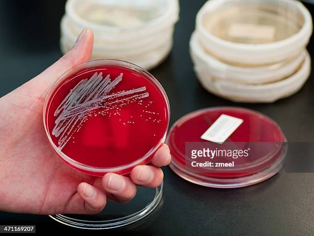 bacterial culture - staphylococcus aureus stockfoto's en -beelden
