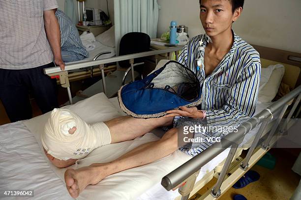 Twenty-one-year-old boy Liu Huichang receives an operation at Southwest Hospital on April 27, 2015 in Chongqing, China. Twenty-one-year-old boy Liu...