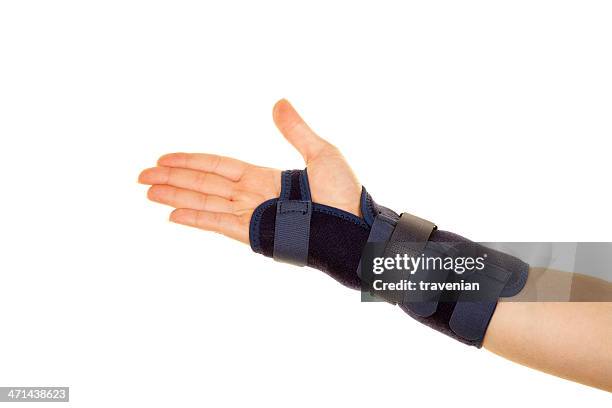 fracture of arm - wrapping arm stock pictures, royalty-free photos & images