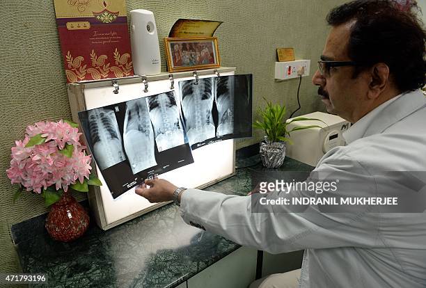 Dean of Mumbai's Lokmanya Tilak Medical College and Hospital Suleman Merchant inspects x-rays showing a pendant and necklace lodged inside the...